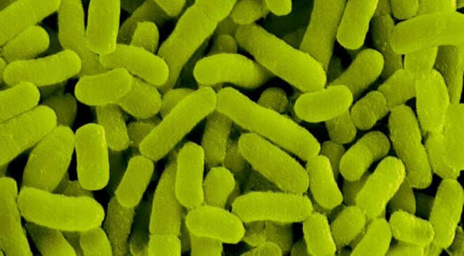 Fastidiosa emergenza. Xylella: cronaca di un’agricoltura che muore e di un’altra che resiste